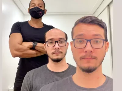 Prótese Capilar antes e depois em Salvador: Recuperação capilar imediata